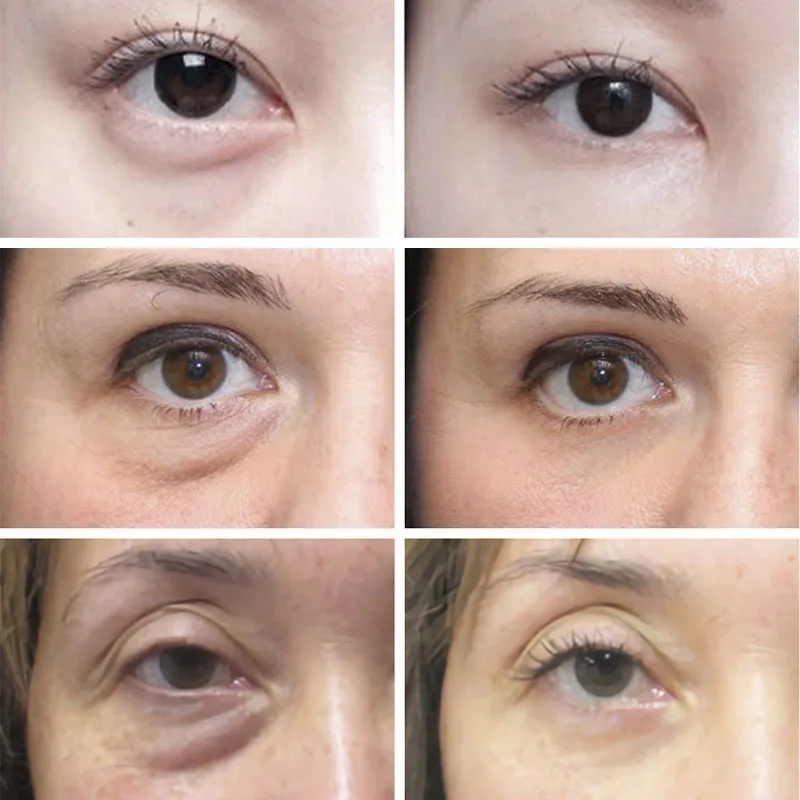 Anti Wrinkle Anti Dark Circle  - Skincare D'Alba ulasan dan harga