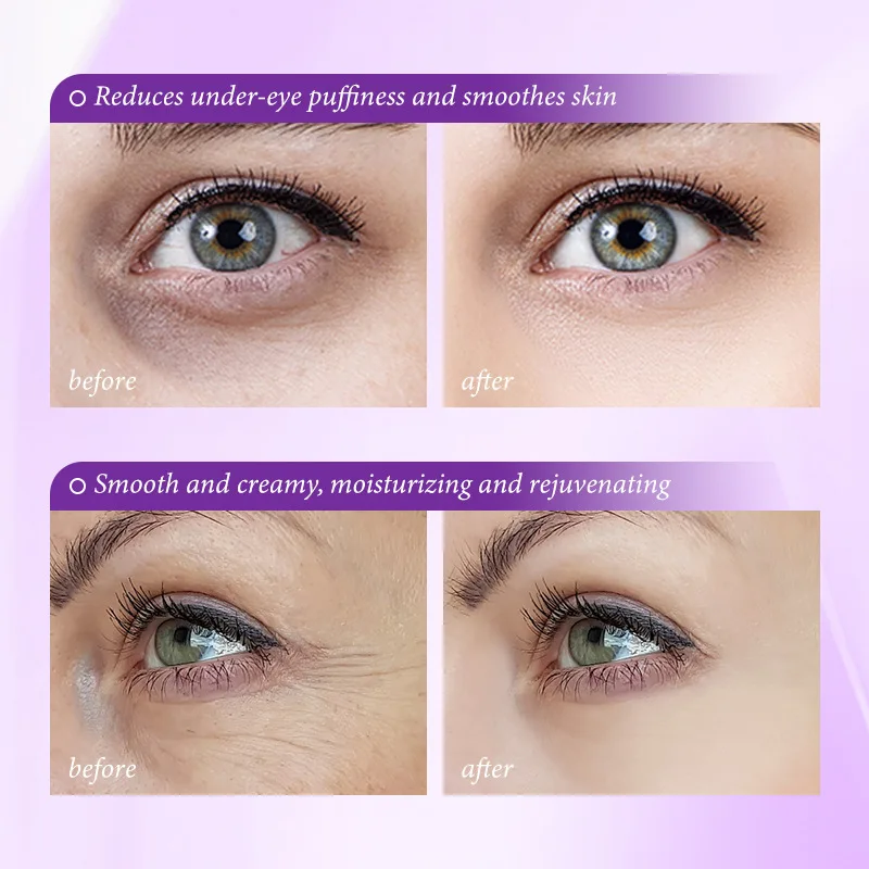 Instant Eye Bag Removal Cream  - Skincare D'Alba ulasan dan harga